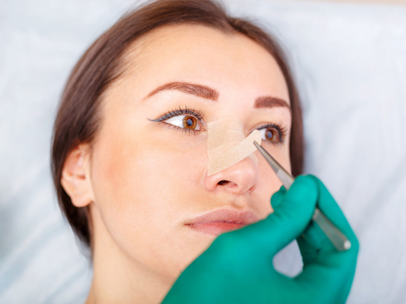 Plastic surgery | Experiences with nose surgery