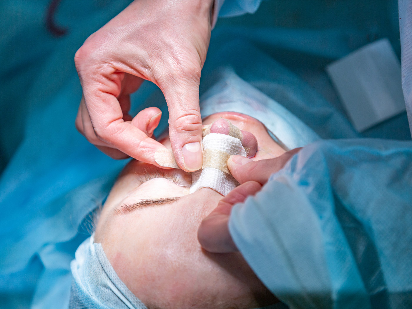 Plastic surgery | How do different cultures view nose surgery?