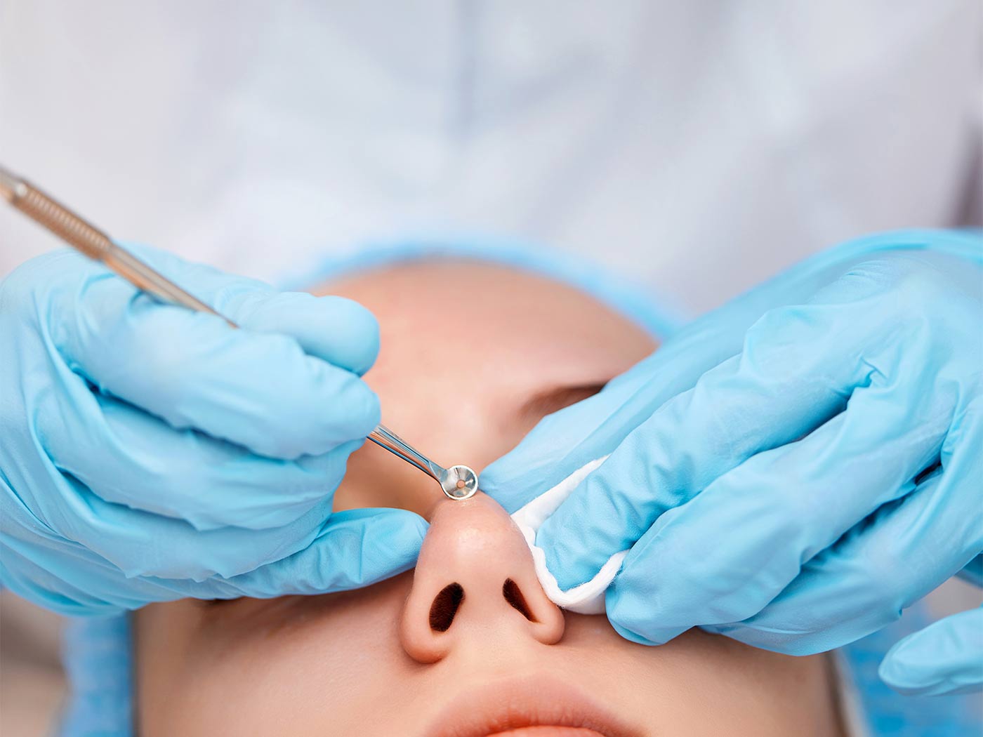Plastic surgery | Nose deviation surgery