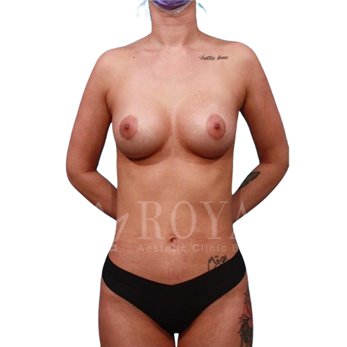 Plastic surgery | Before and after