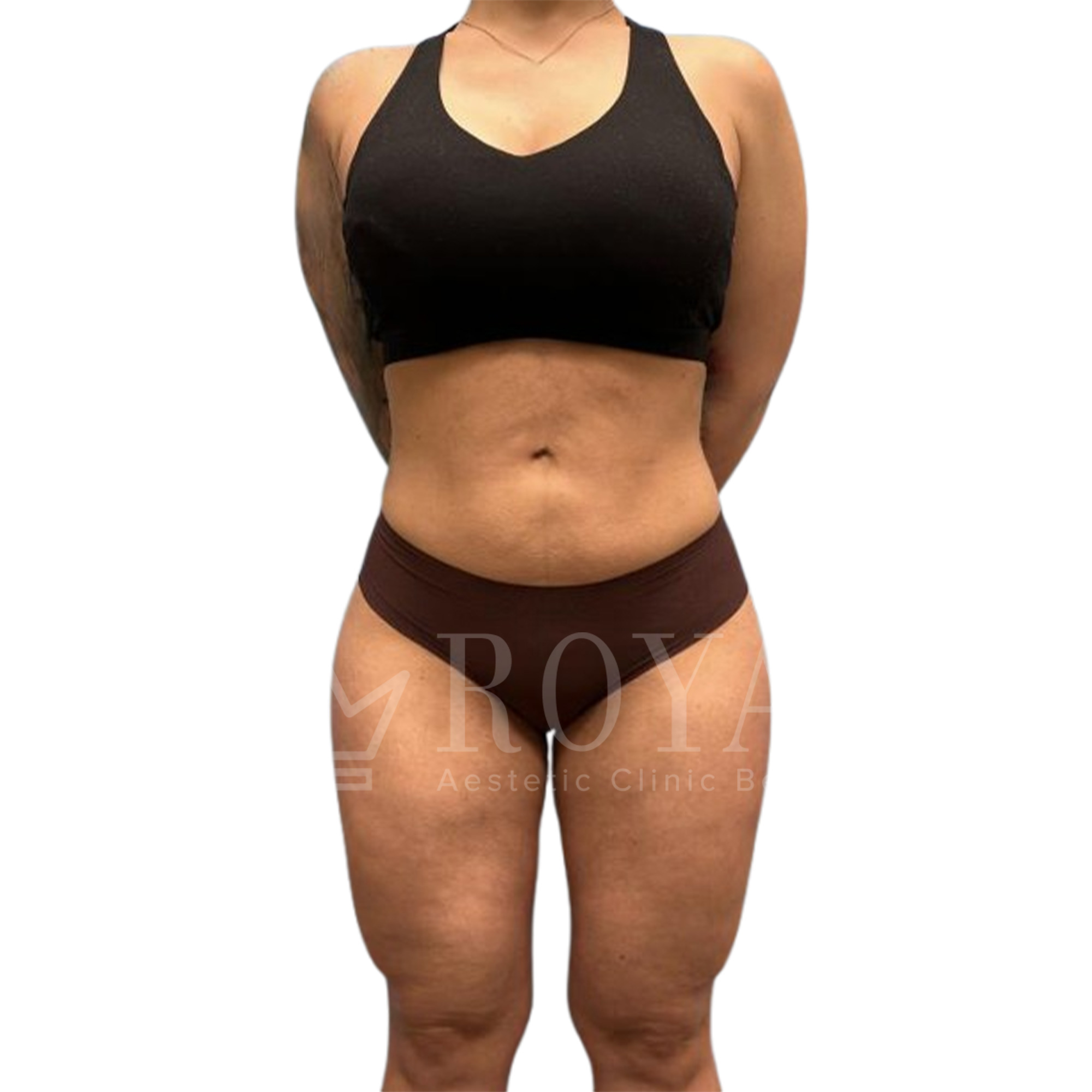 Plastic surgery | Before and after