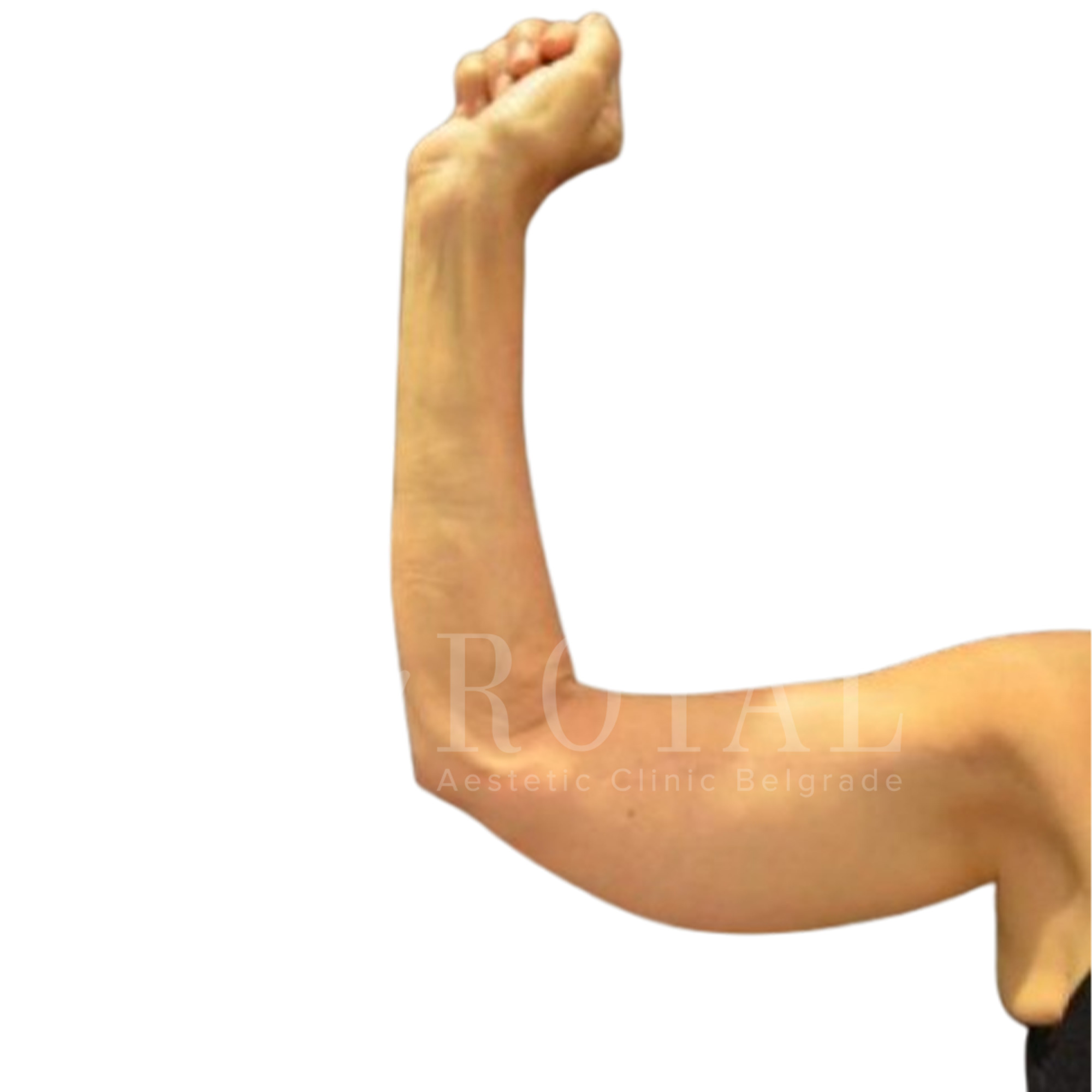 Plastic surgery | Before and after
