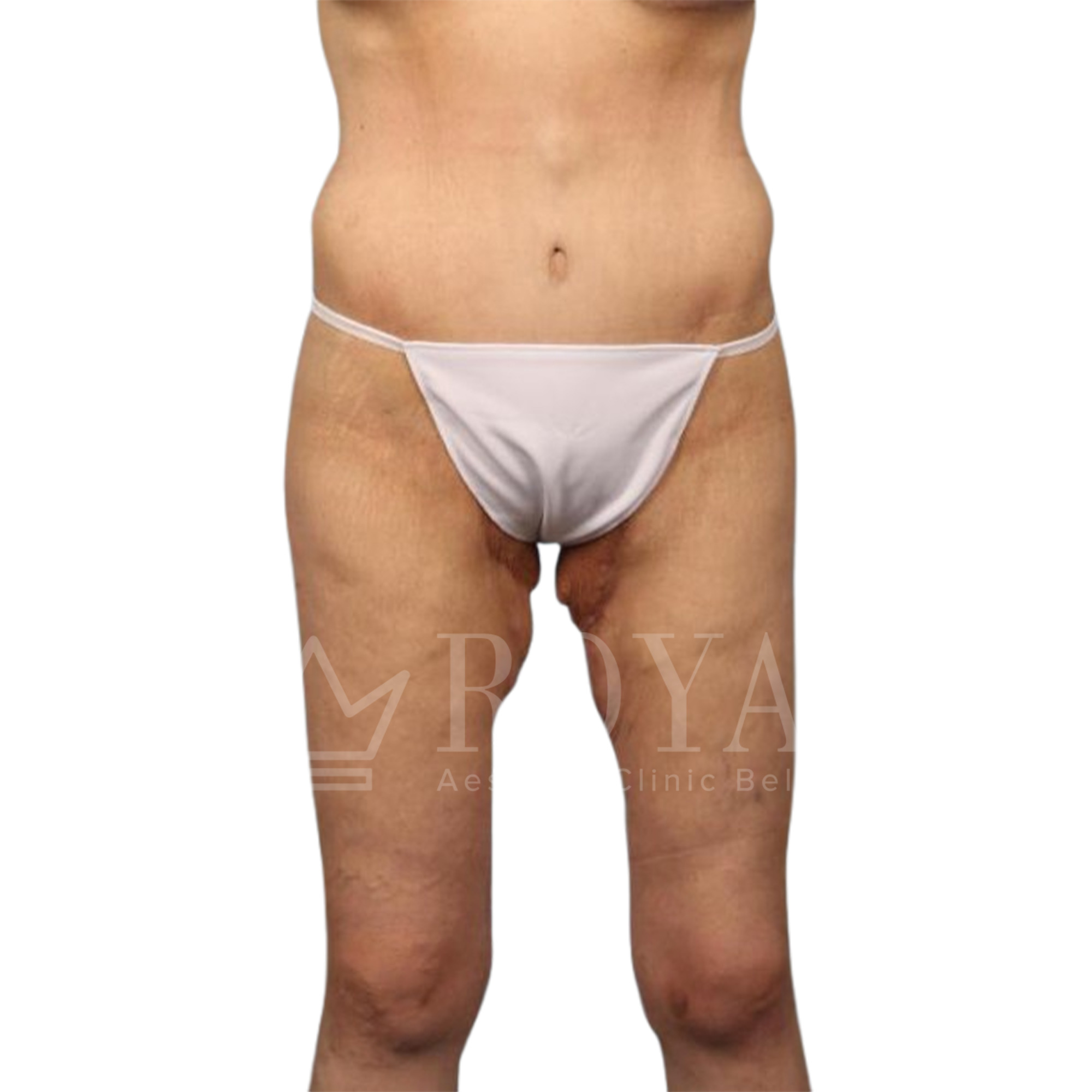 Plastic surgery | Before and after