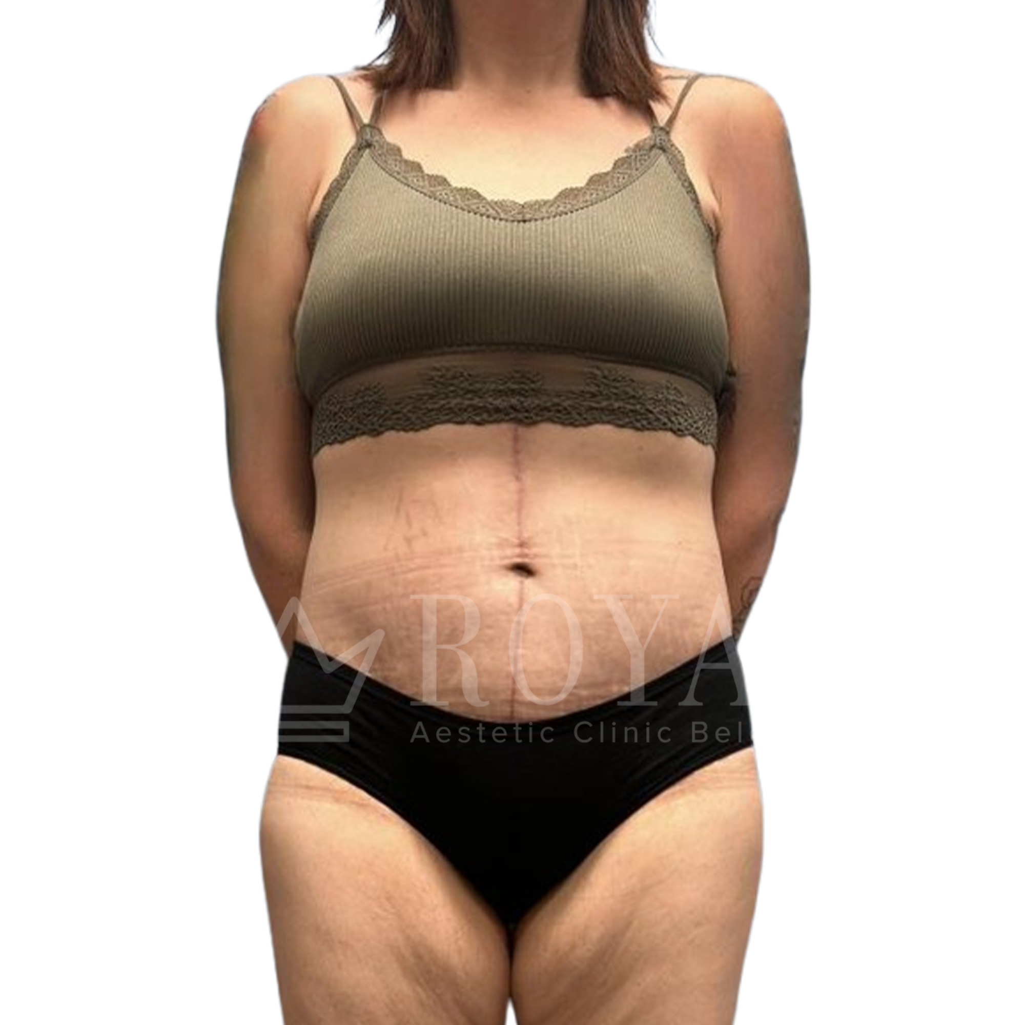 Plastic surgery | Before and after