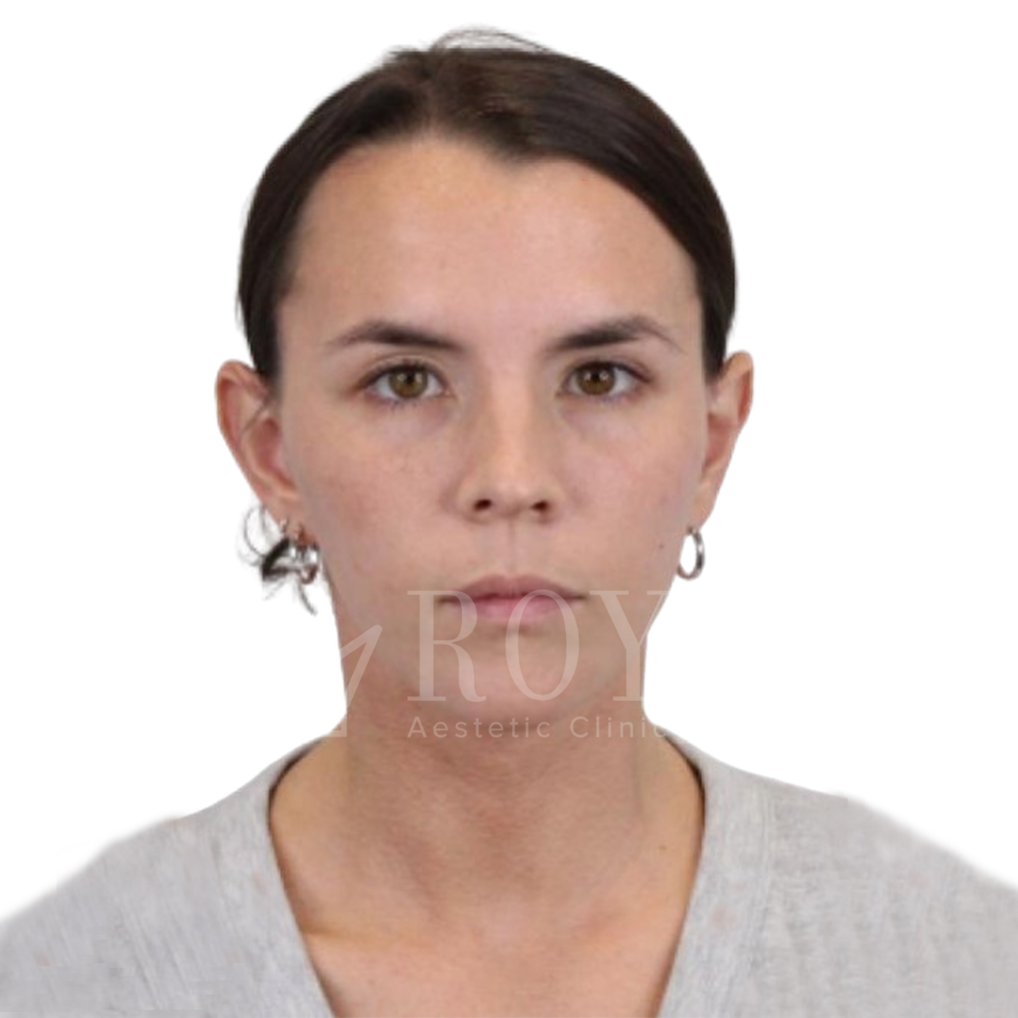 Plastic surgery | Before and after