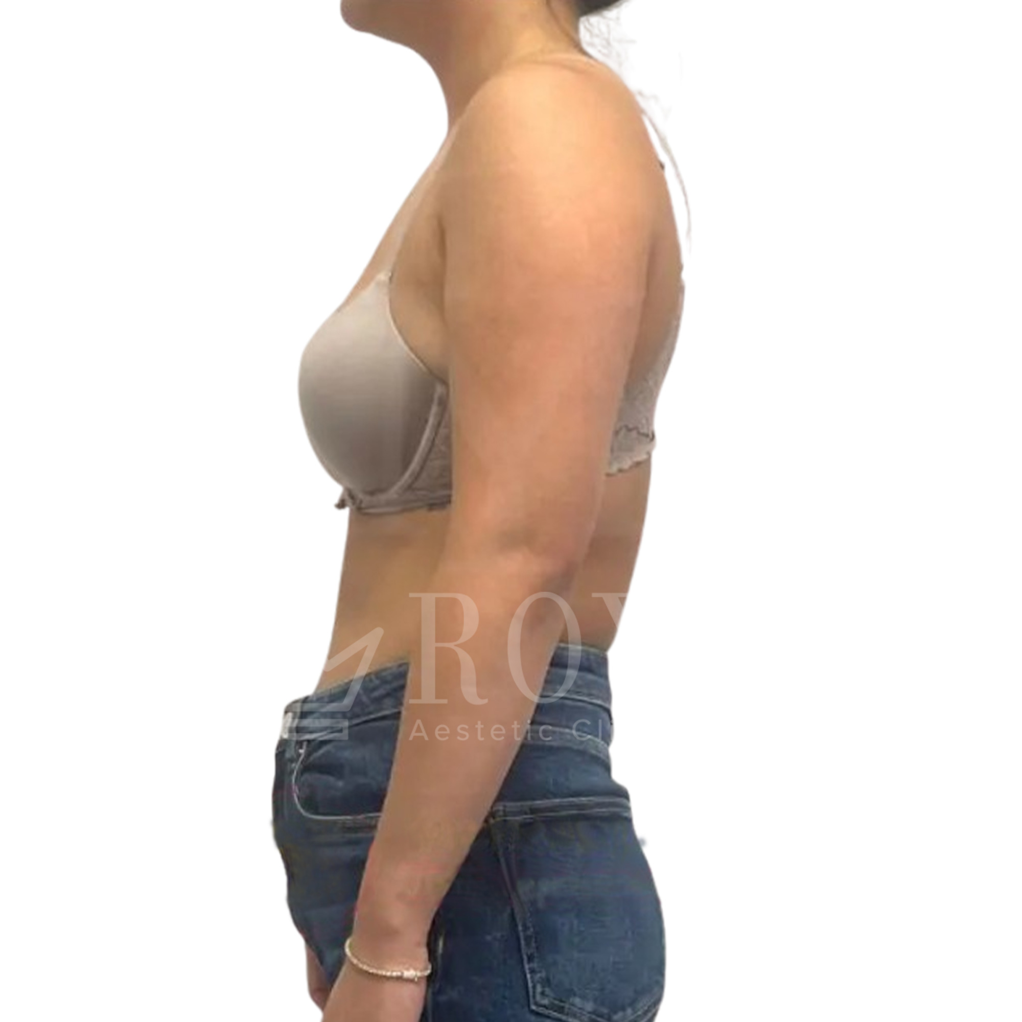 Plastic surgery | Before and after