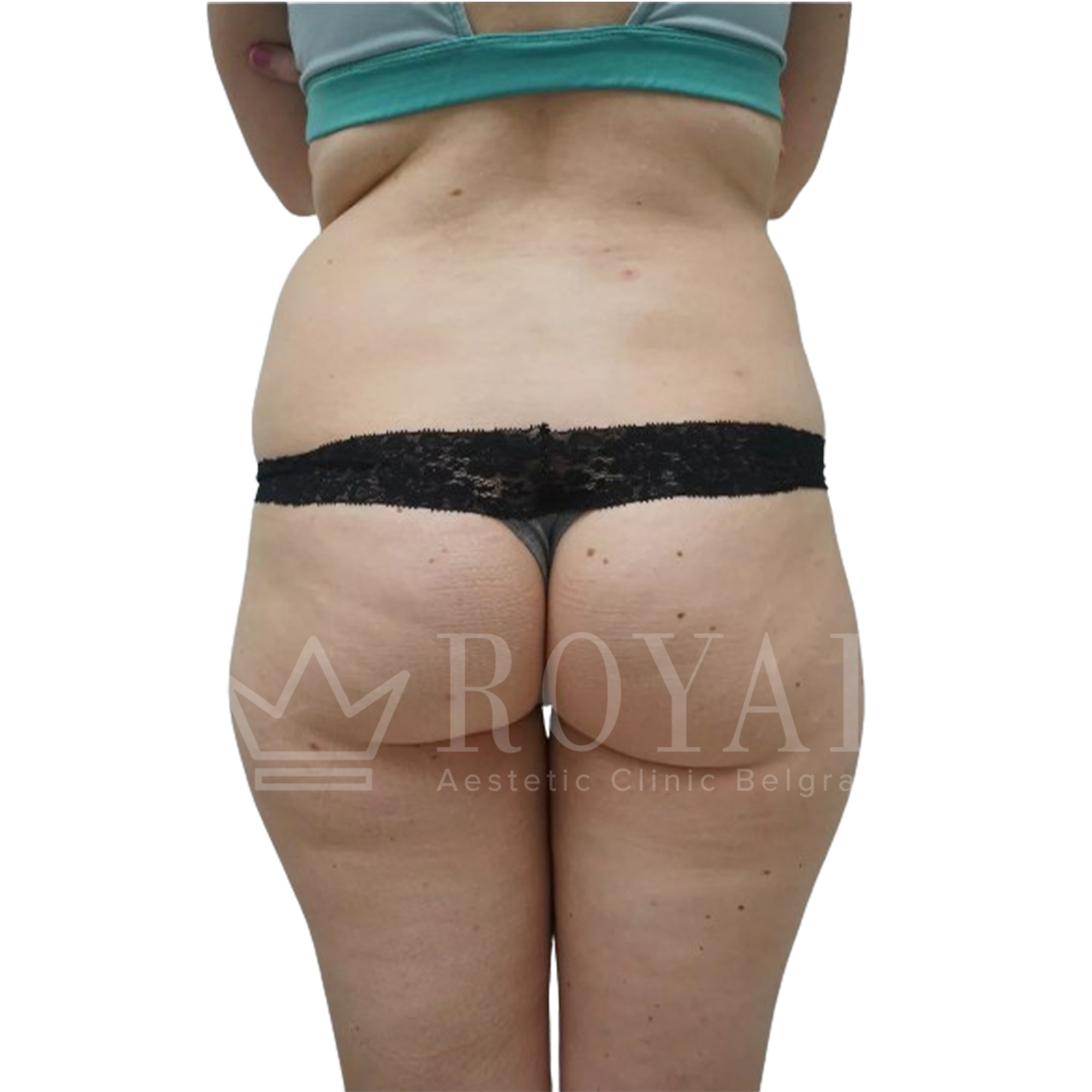 Plastic surgery | Before and after