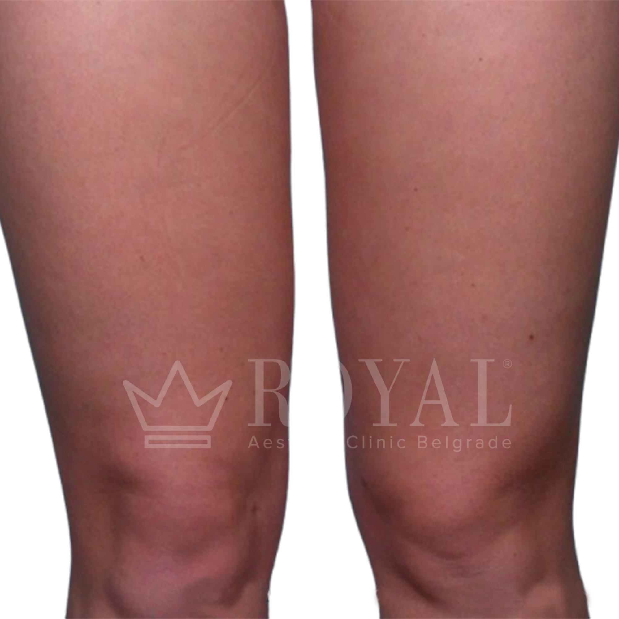 Plastic surgery | Before and after