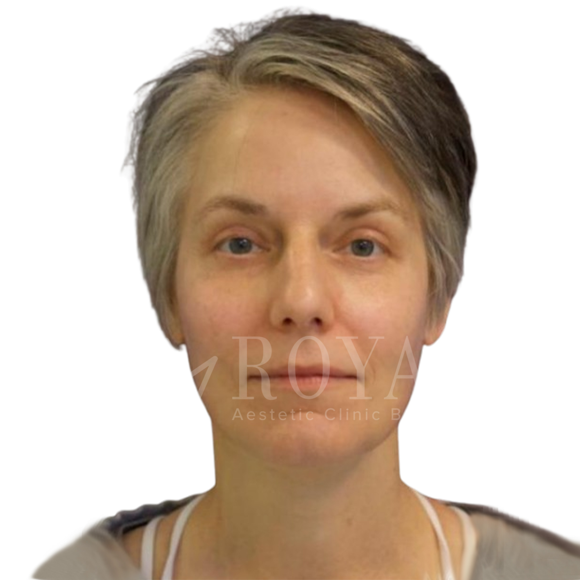 Plastic surgery | Before and after