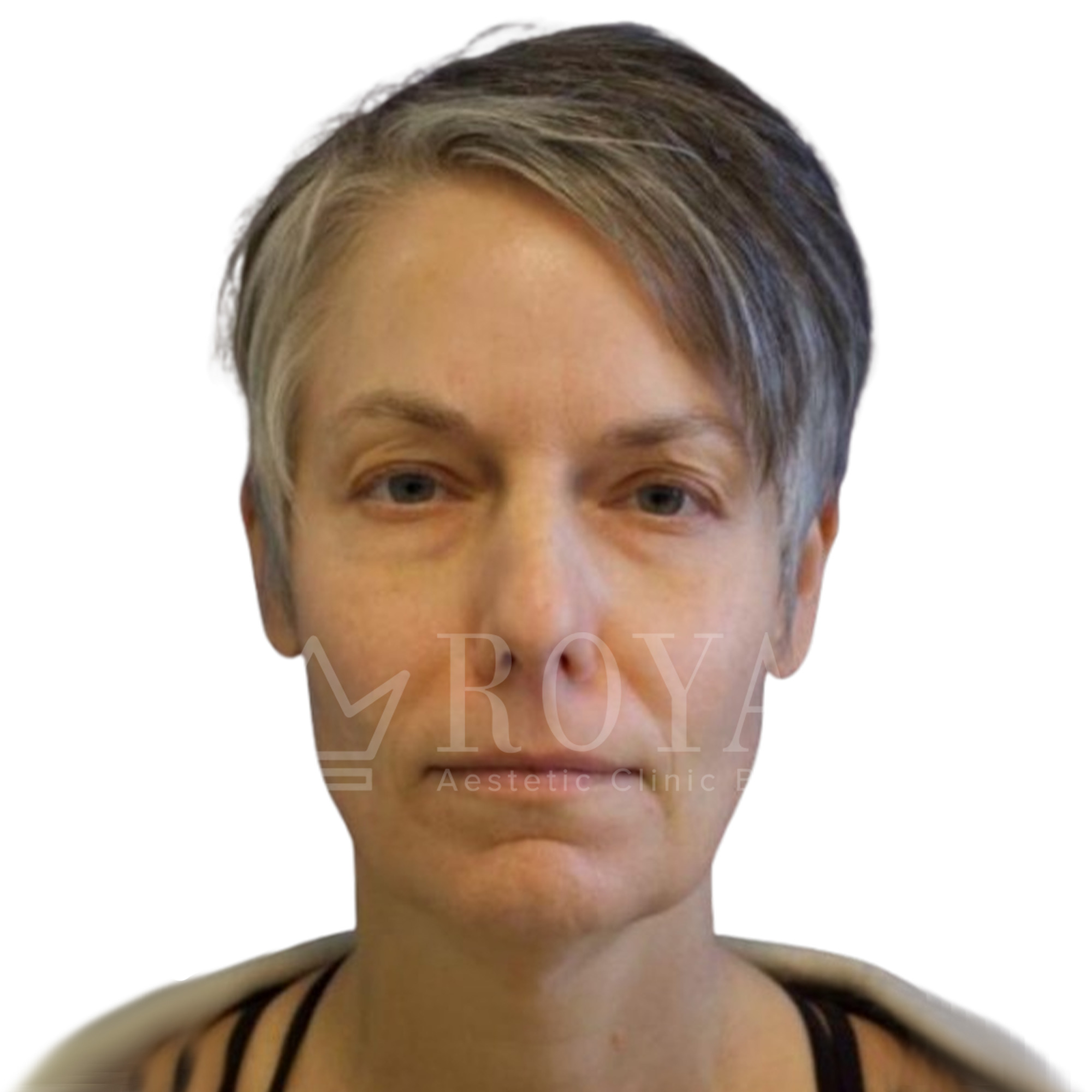 Plastic surgery | Before and after