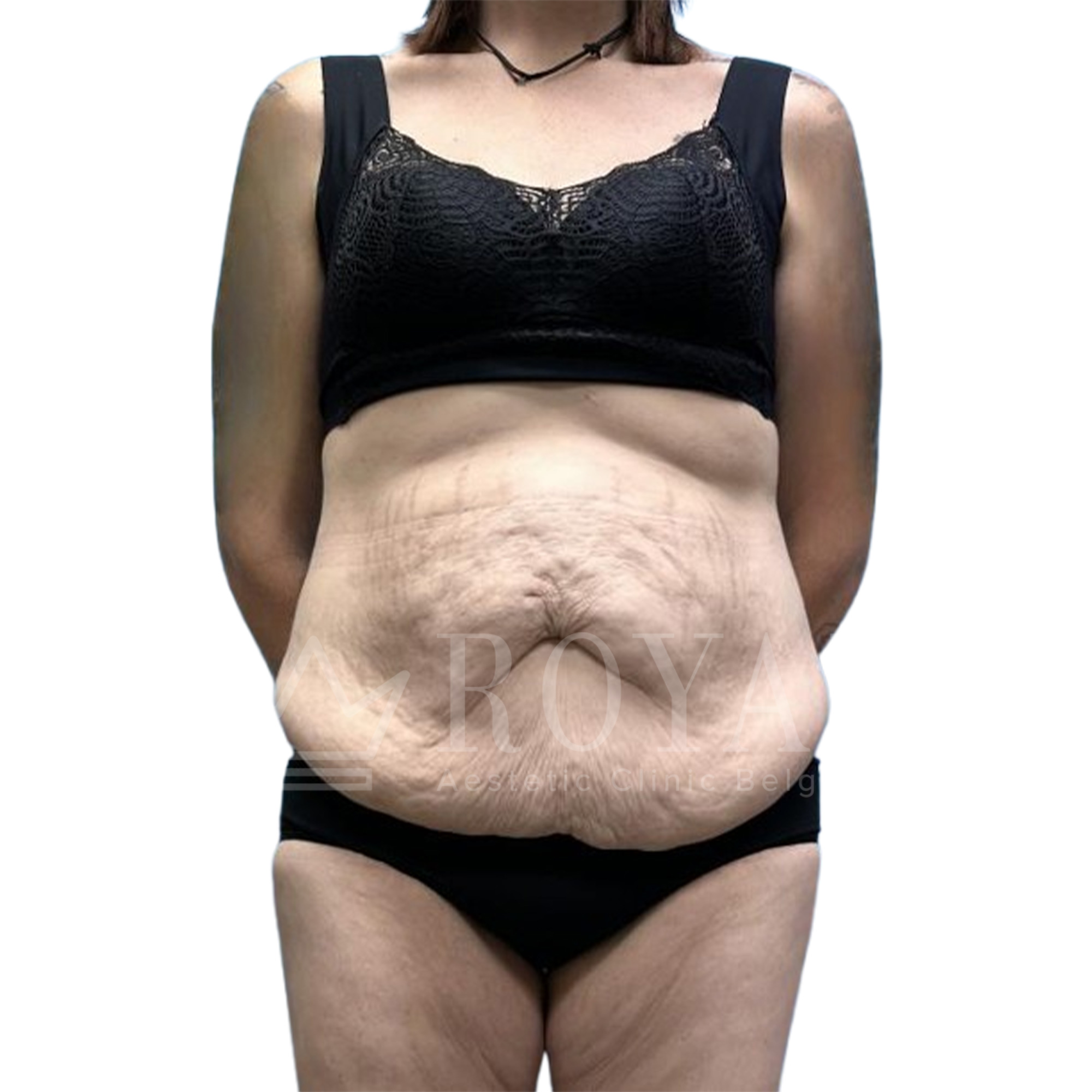Plastična hirurgija | Pre i posle
