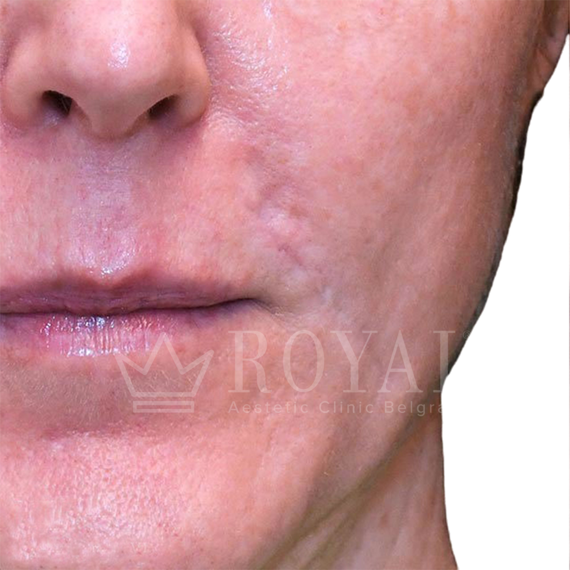 Plastična hirurgija | Pre i posle