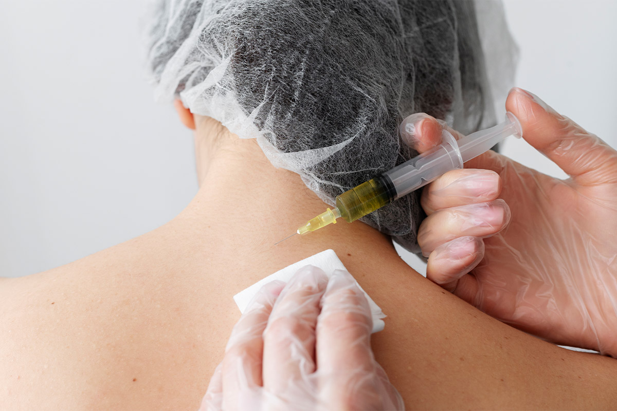 Atheroma removal | Atheroma removal