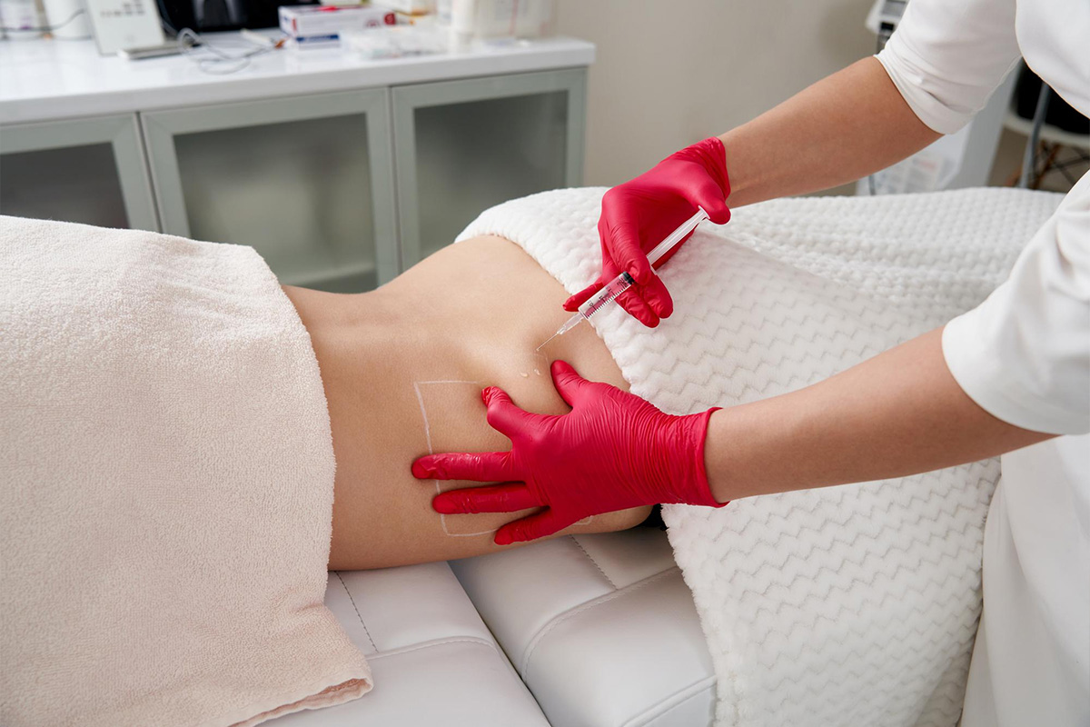 Back liposuction | Back liposuction