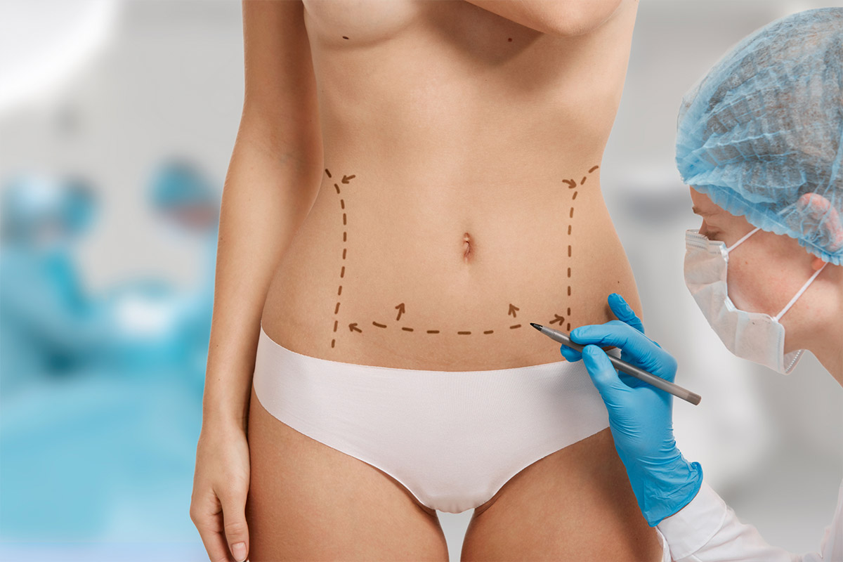 What is plastic surgery? | What is plastic surgery?