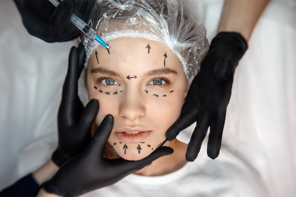 Face lifting | Face lifting