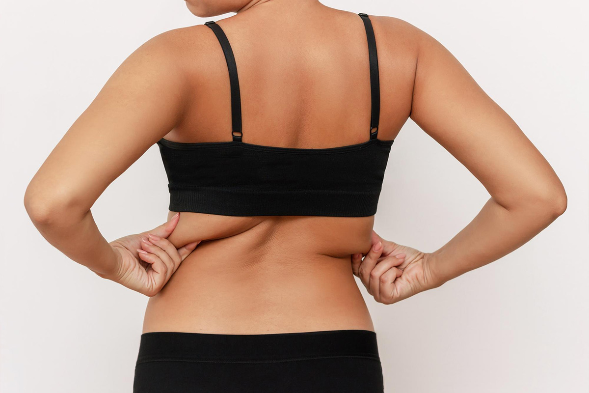 Liposukcija leđa (infrascapular) | Liposukcija leđa (infrascapular)